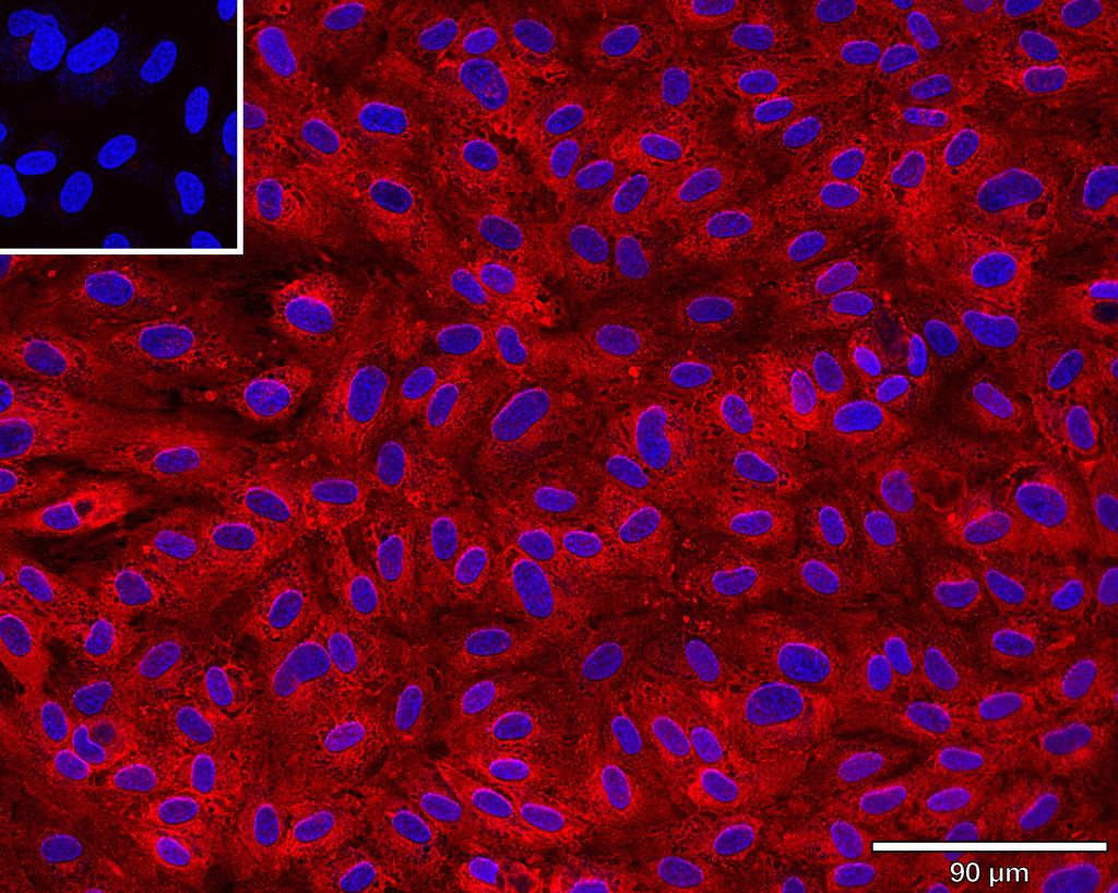 Ankyron CD34_HUMAN Clone AR40149
