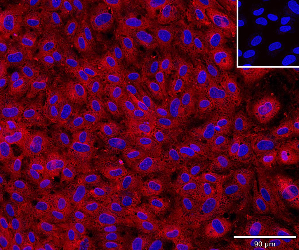 Ankyron CD34_HUMAN Clone AR40148