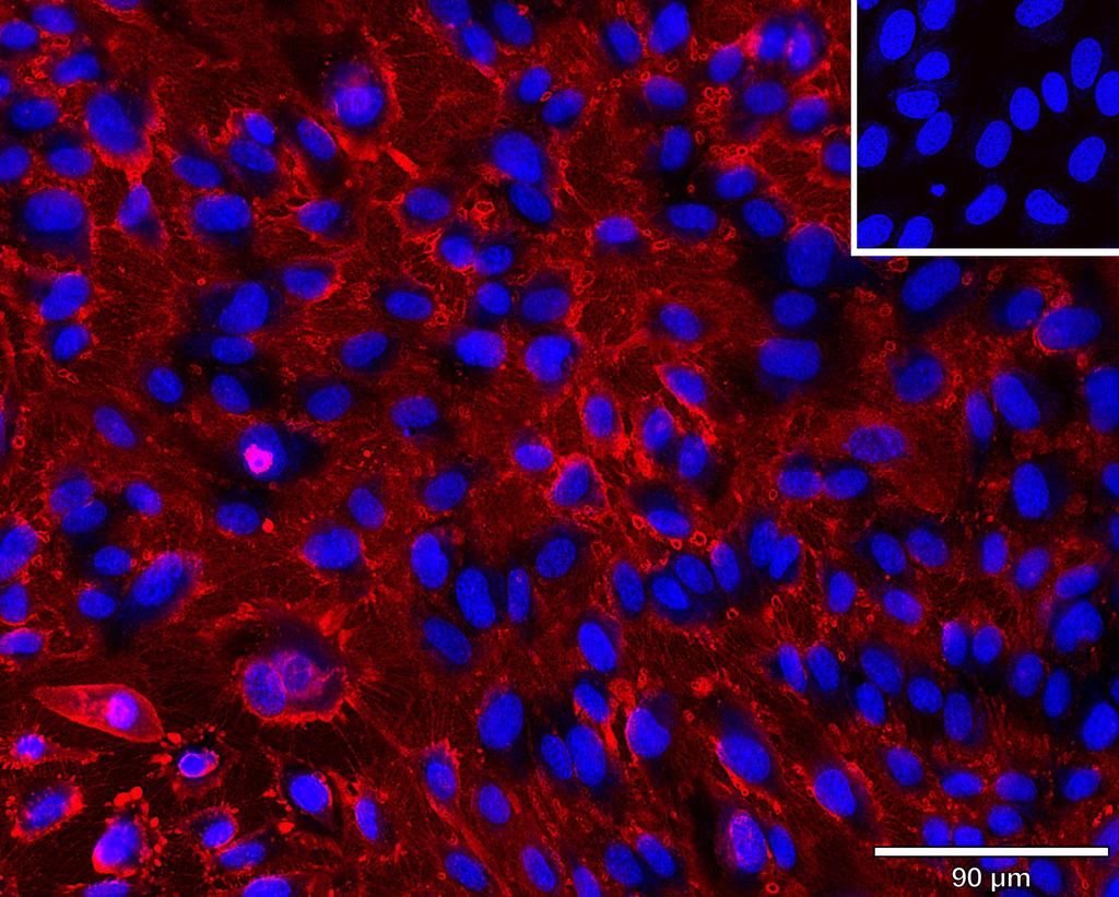 Ankyron CD34_HUMAN Clone AR40147