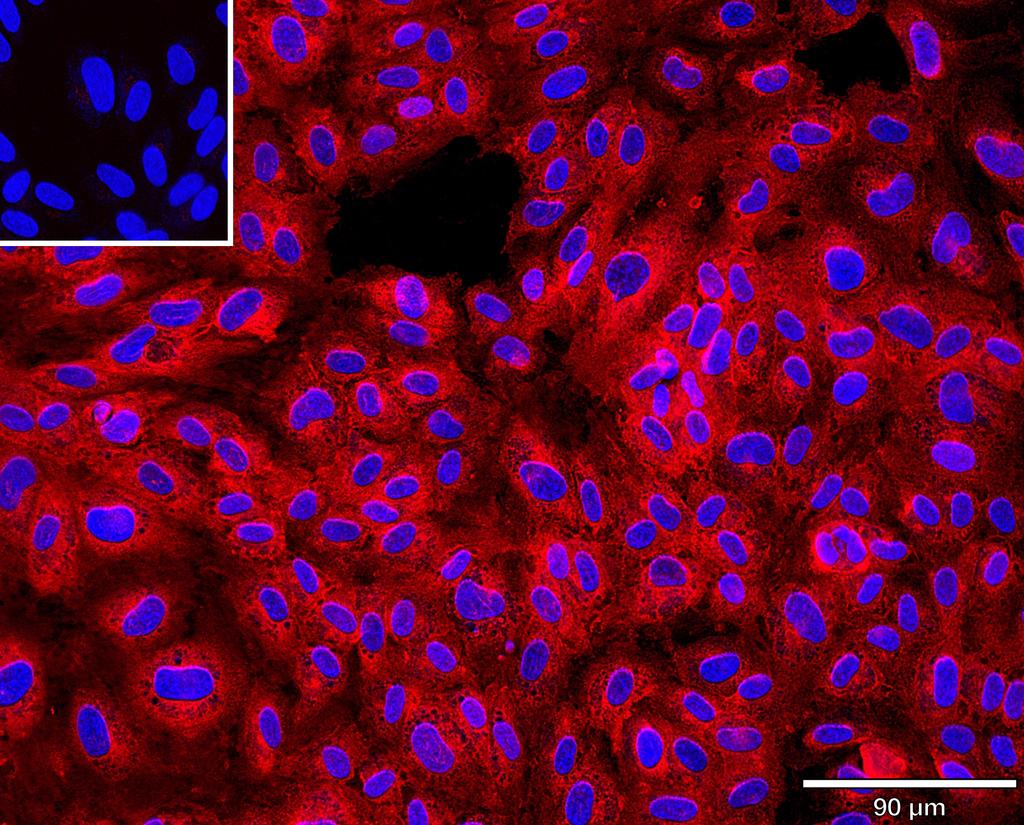 Ankyron CD34_HUMAN Clone AR40153