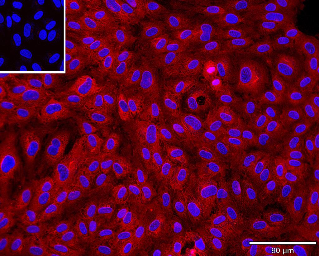 Ankyron CD34_HUMAN Clone AR40144