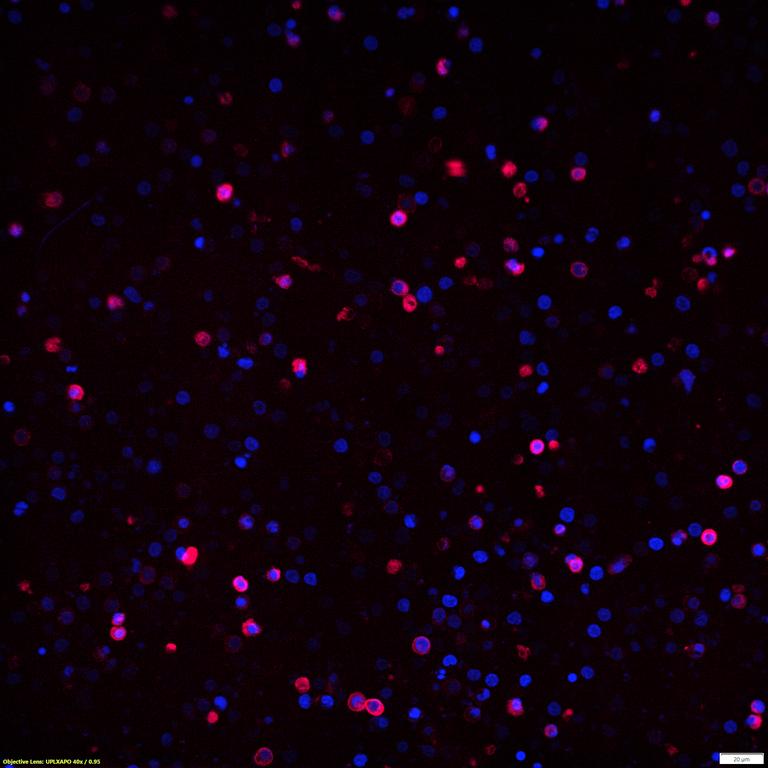 Ankyron CD3Z_HUMAN Clone EF20119