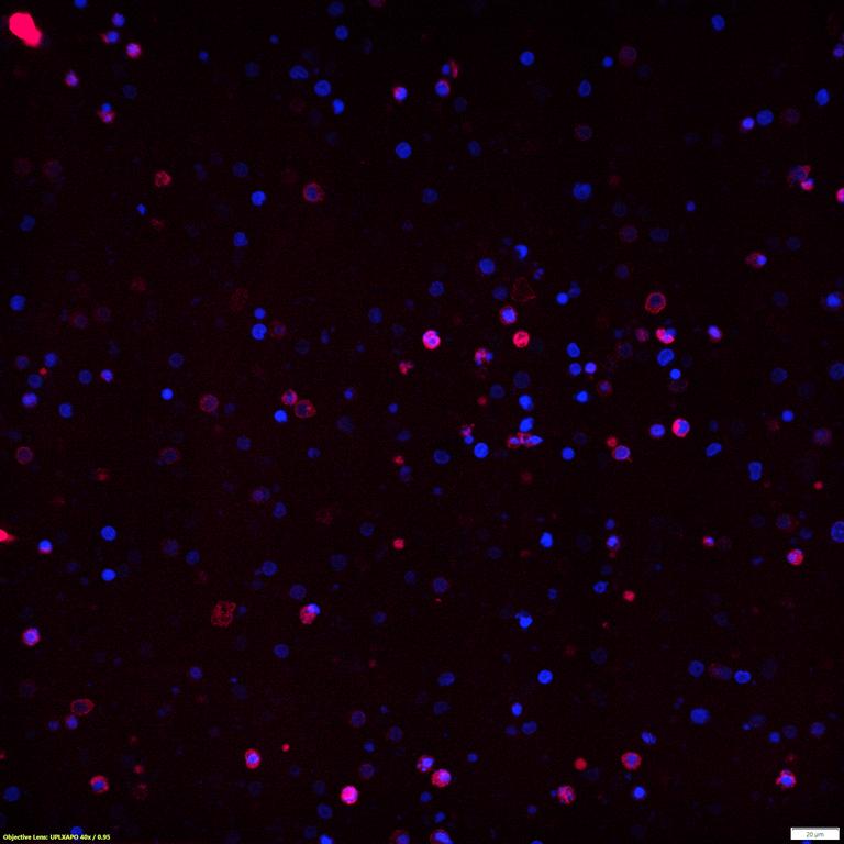 Ankyron CD3Z_HUMAN Clone EF20120