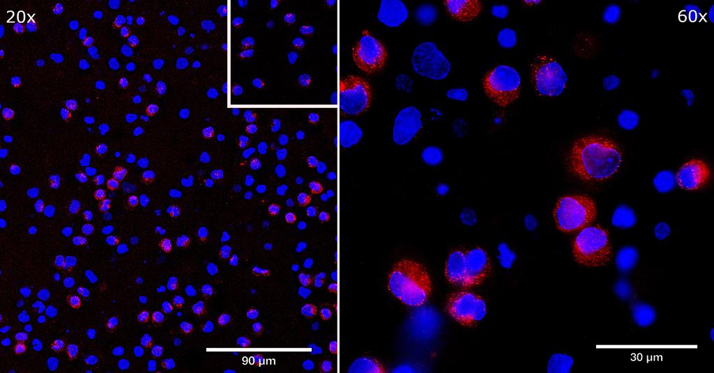 Ankyron CD40L_HUMAN Clone AB40458