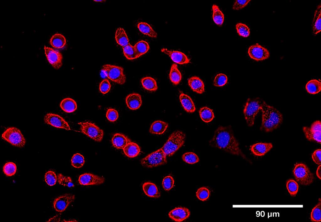 Ankyron CD44_HUMAN Clone BV40957