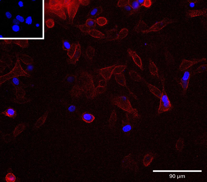 Ankyron CD44_HUMAN Clone CS31023