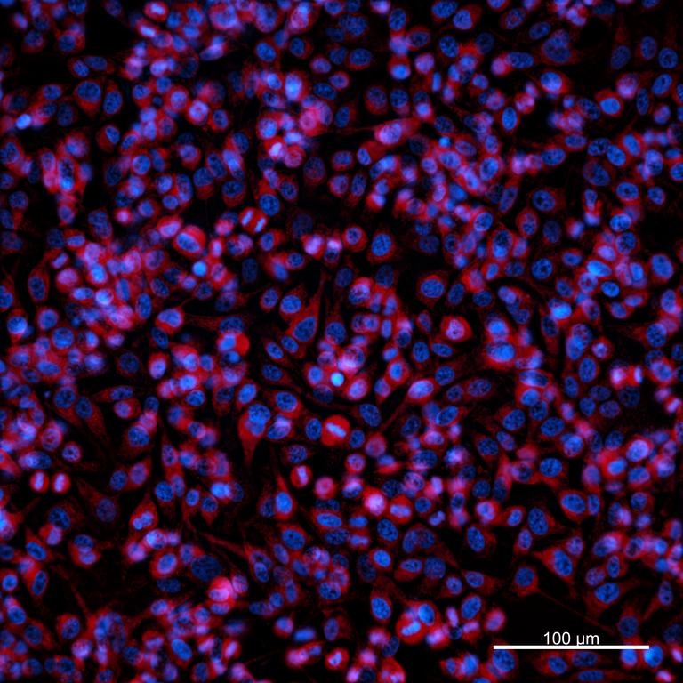 Ankyron CD47_HUMAN Clone AC40270