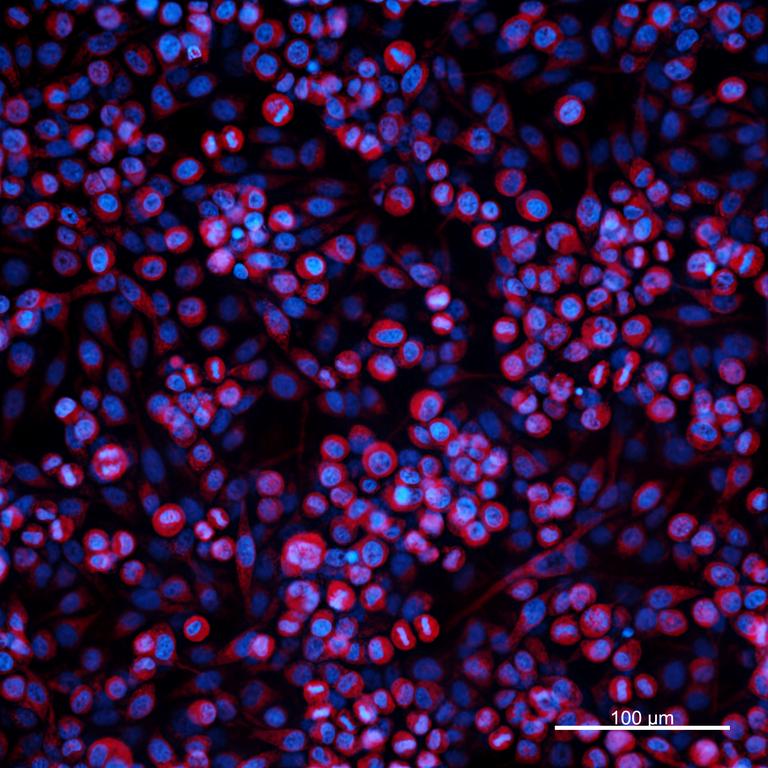 Ankyron CD47_HUMAN Clone AC40246