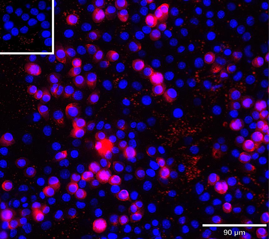 Ankyron CD47_MOUSE Clone AU40322
