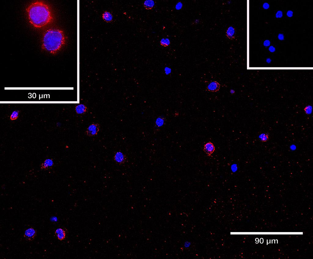 Ankyron CD4_HUMAN Clone AA40112