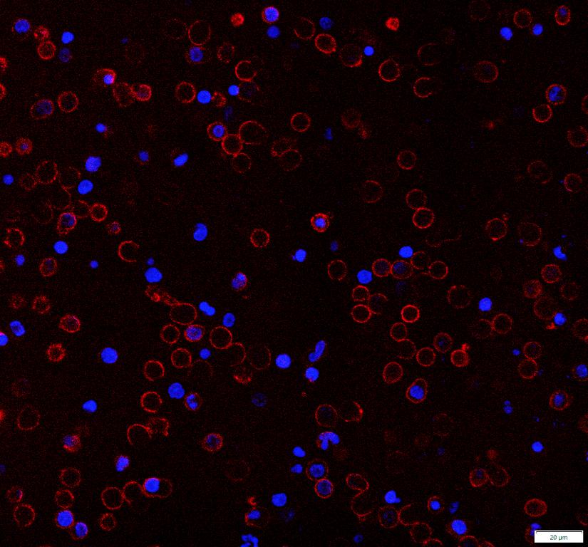 Ankyron CD4_HUMAN Clone AA40191