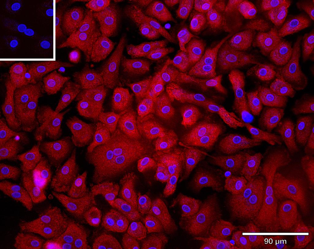 Ankyron CD5_HUMAN Clone AE50106