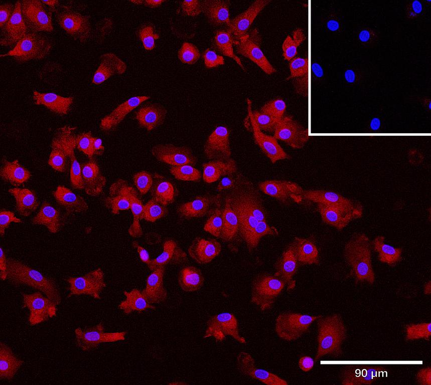 Ankyron CD5L_HUMAN Clone CV40370