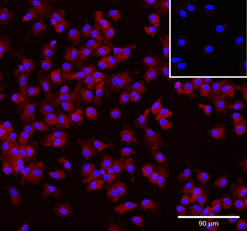 Ankyron CD5L_HUMAN Clone CV40373