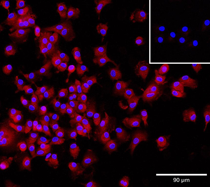 Ankyron CD5L_HUMAN Clone CV40380