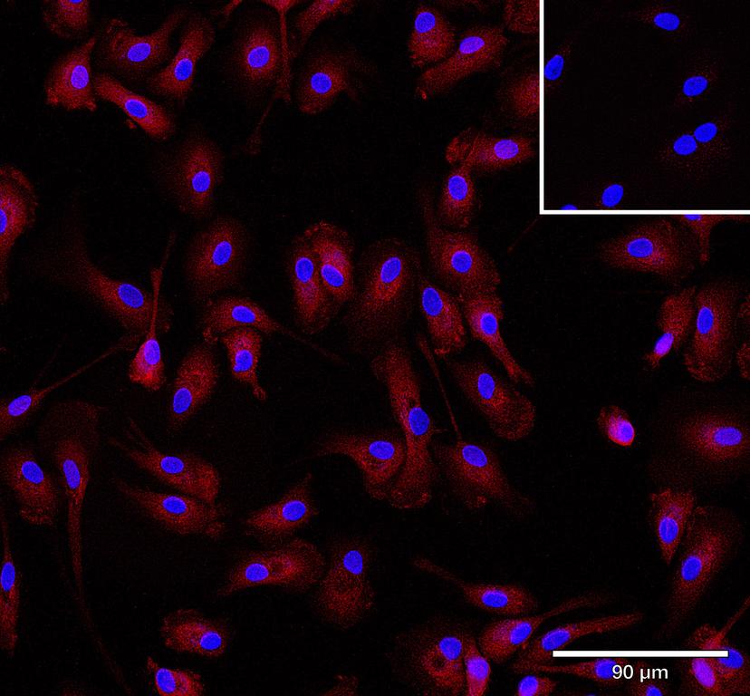 Ankyron CD5L_HUMAN Clone CV40384