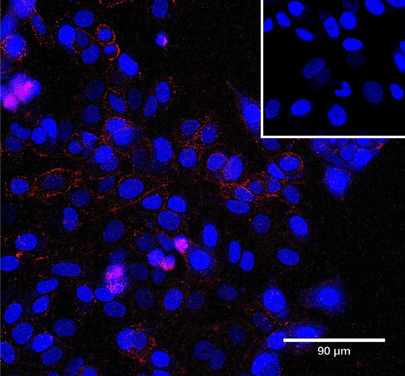 Ankyron CD81_HUMAN Clone CS30667