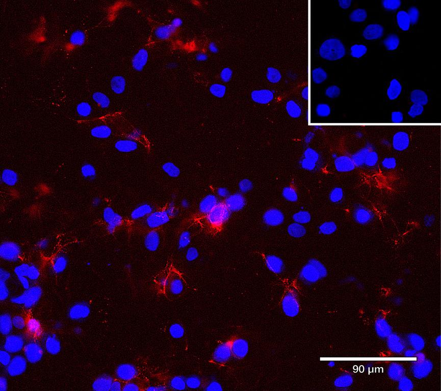 Ankyron CD81_HUMAN Clone CS30670