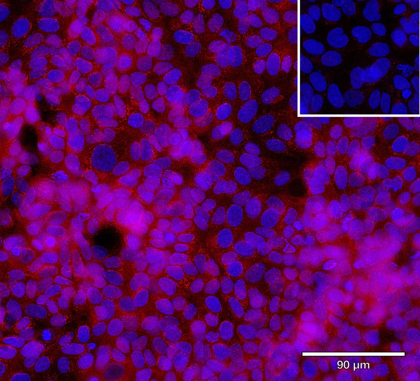 Ankyron CD81_HUMAN Clone CS30662
