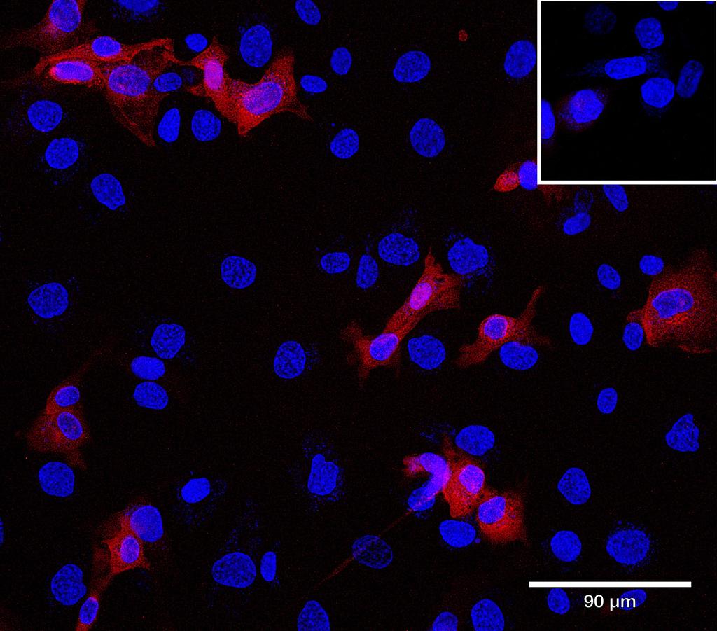 Ankyron CD83_HUMAN Clone AB40478