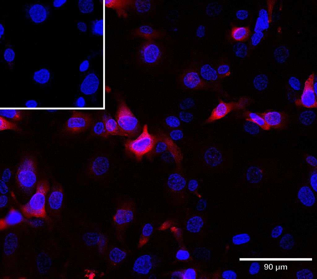 Ankyron CD83_HUMAN Clone AB40484