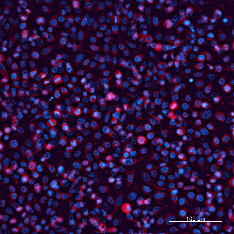 Ankyron CDC5L_HUMAN Clone FN40907