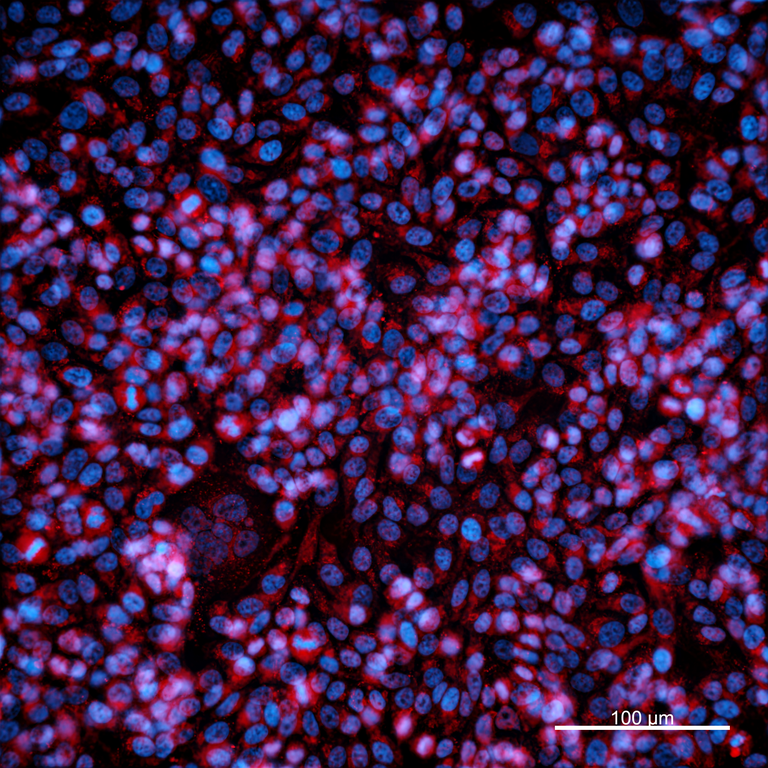 Ankyron CDK16_HUMAN Clone EF20107