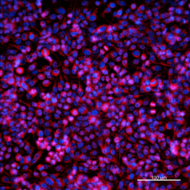 Ankyron CDK16_HUMAN Clone EF20115