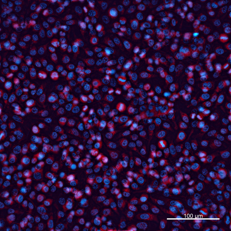 Ankyron CDK16_HUMAN Clone EF20110