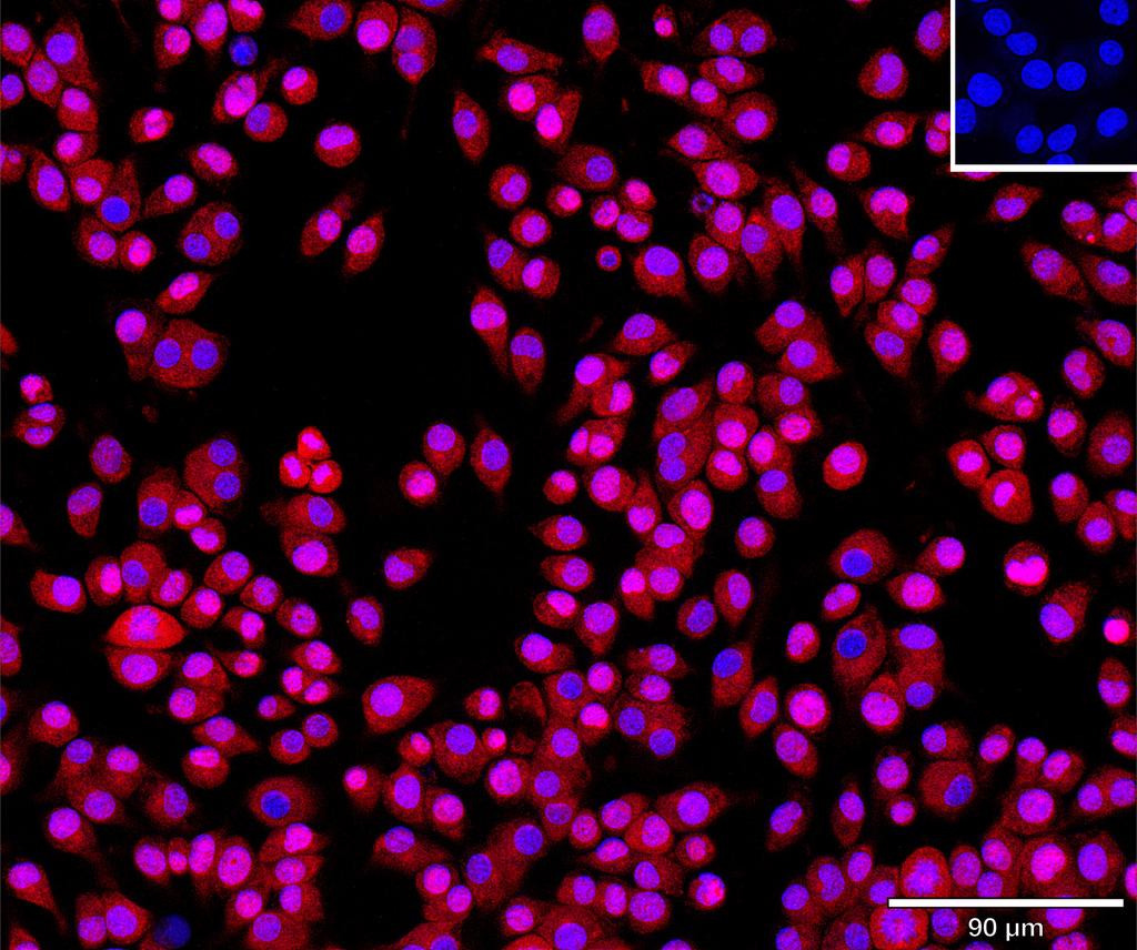 Ankyron CDNF_MOUSE Clone AU40131