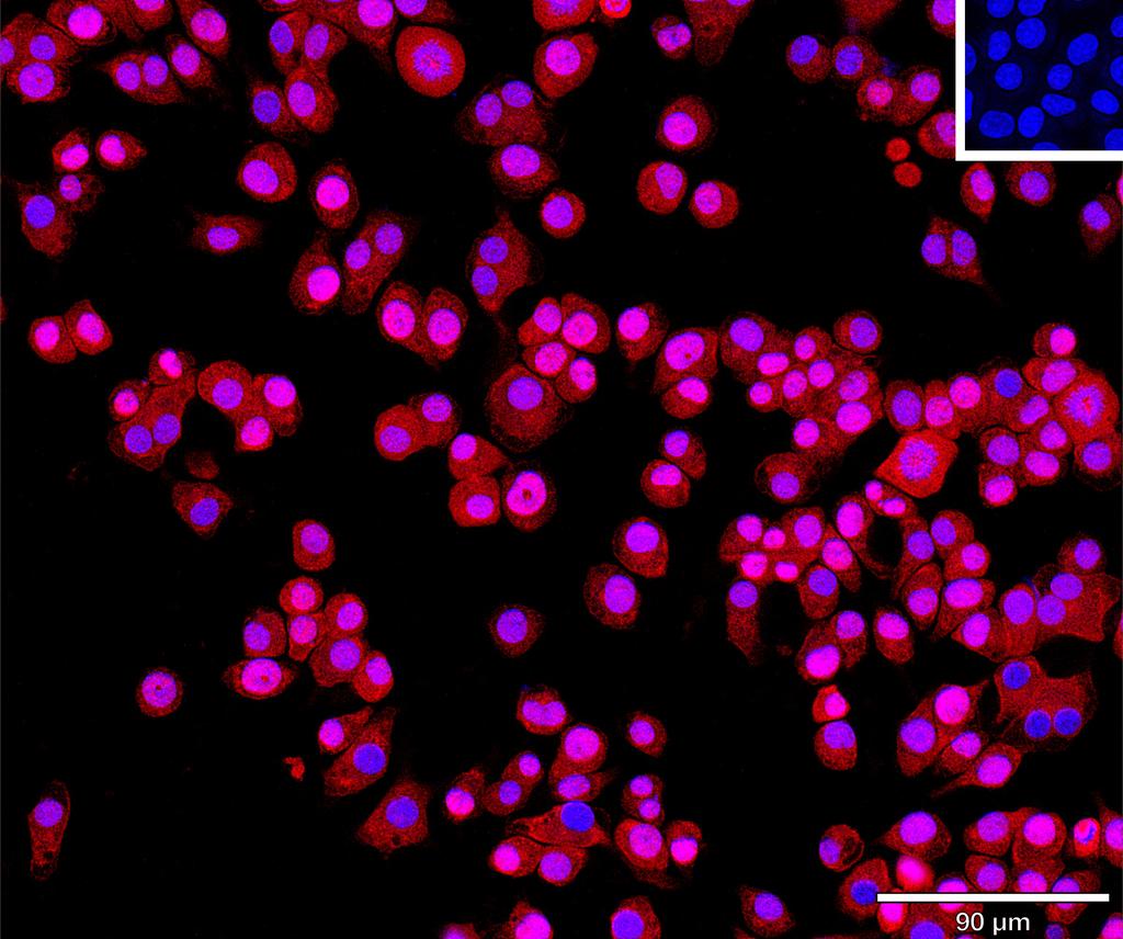 Ankyron CDNF_MOUSE Clone AU40136