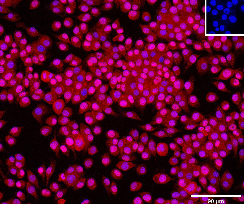 Ankyron CDNF_MOUSE Clone AU40138
