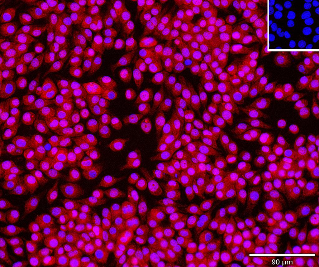 Ankyron CDNF_MOUSE Clone AU40133