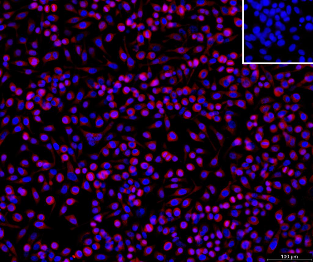 Ankyron CER1_HUMAN Clone DB40483