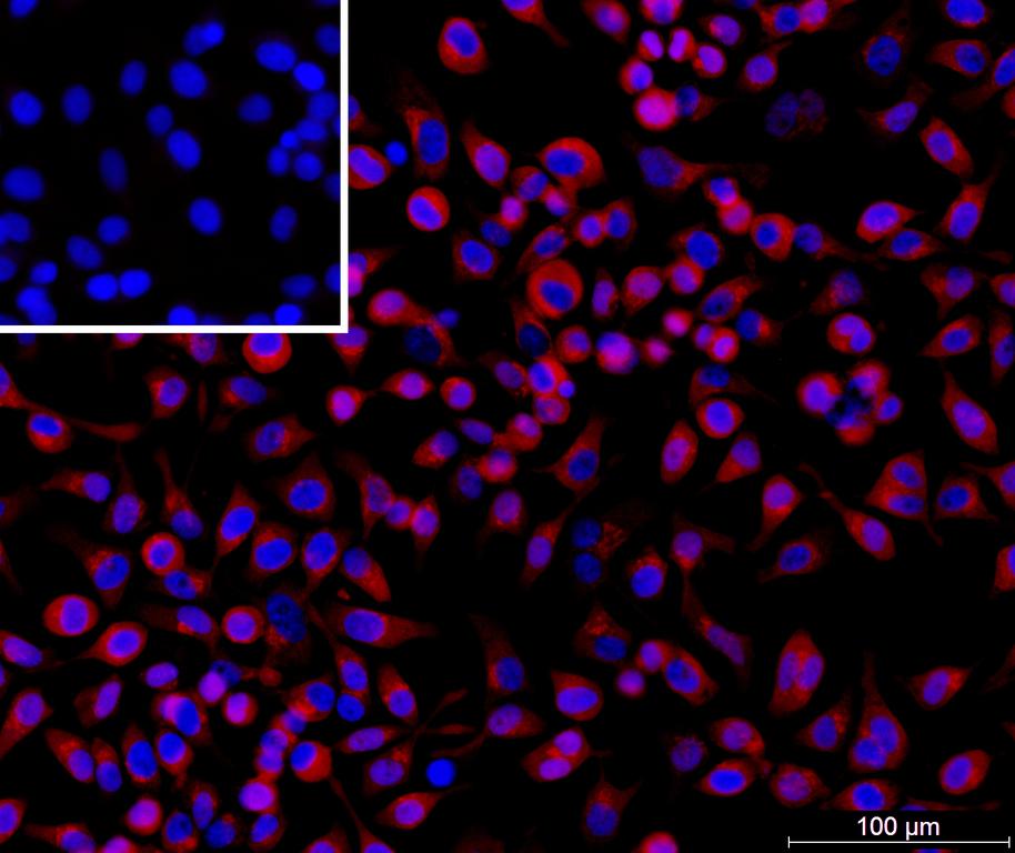 Ankyron CER1_HUMAN Clone DB40480