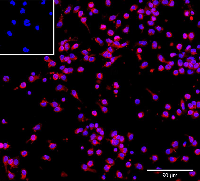 Ankyron CFAD_HUMAN Clone CV40446