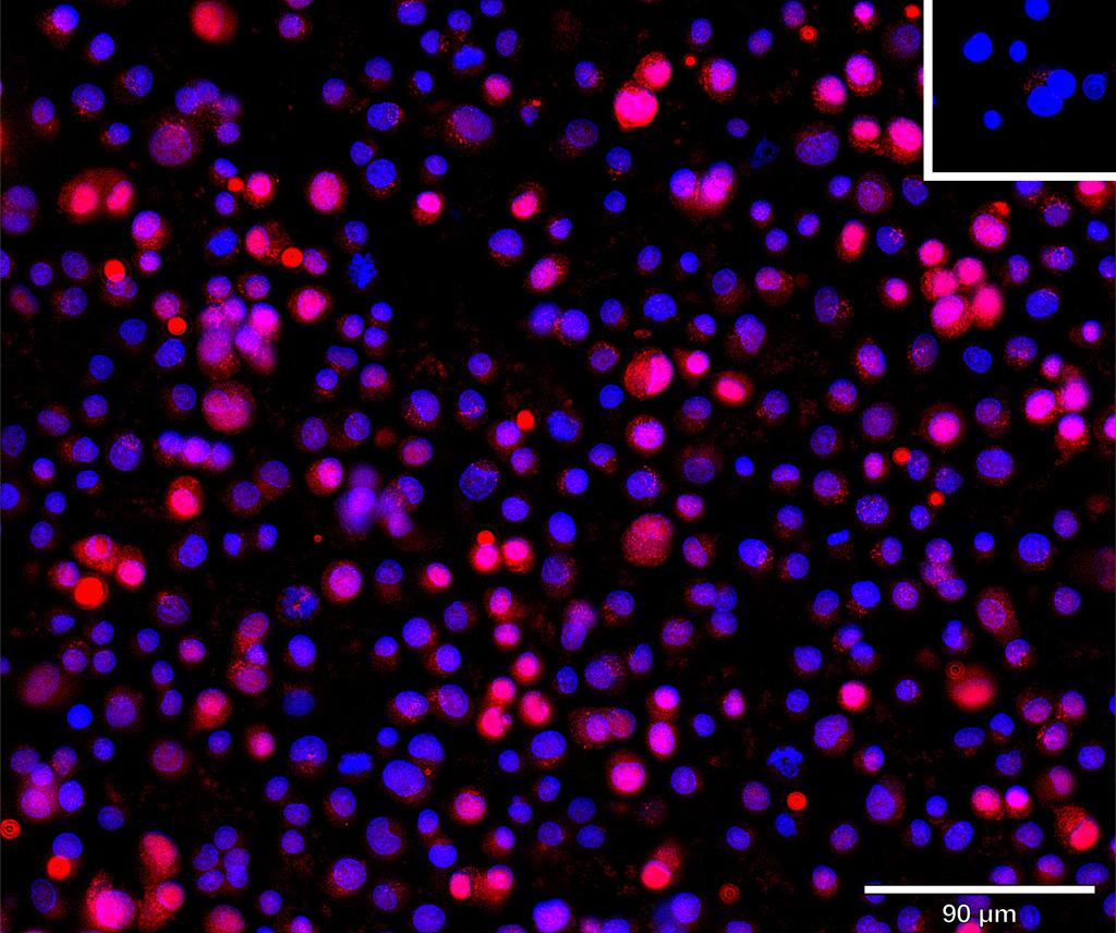 Ankyron CGB3_HUMAN Clone CB30378