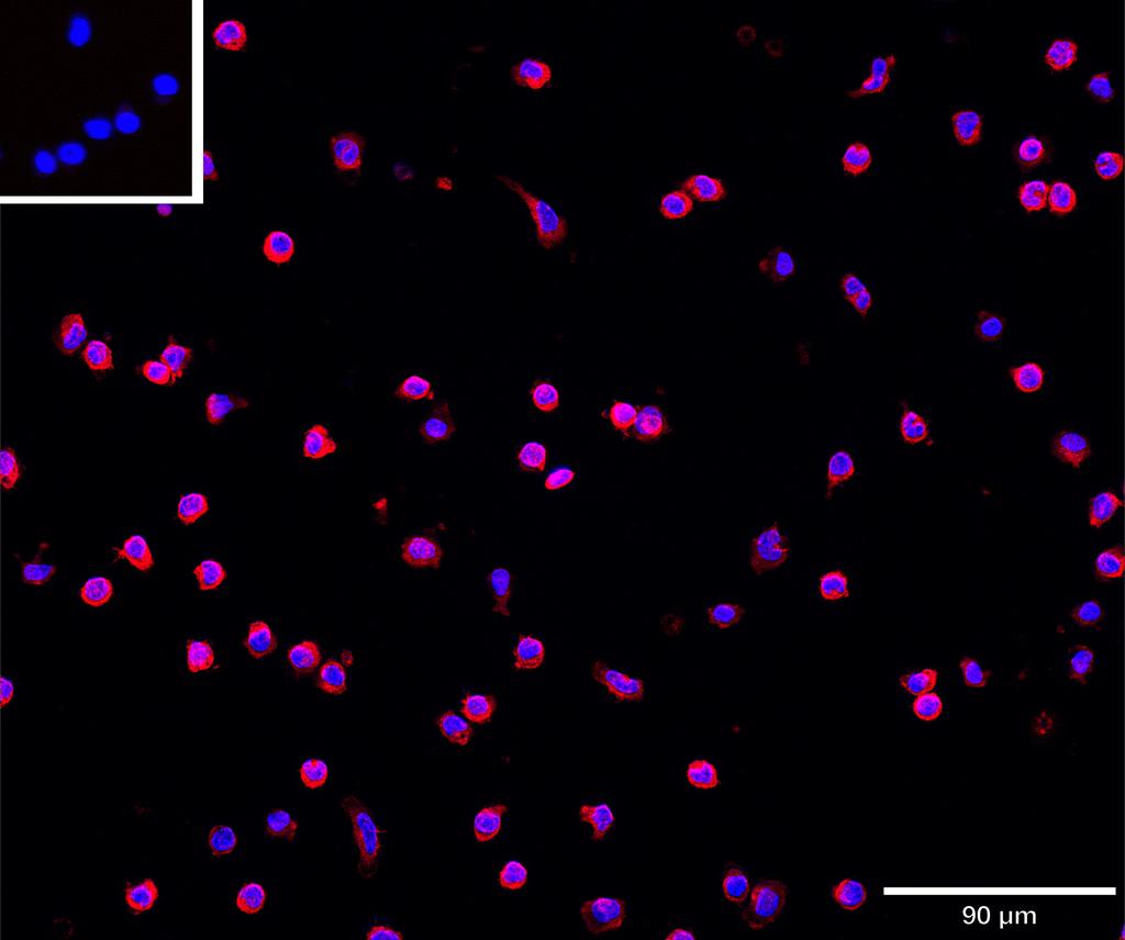 Ankyron CH3L1_HUMAN Clone CV40641
