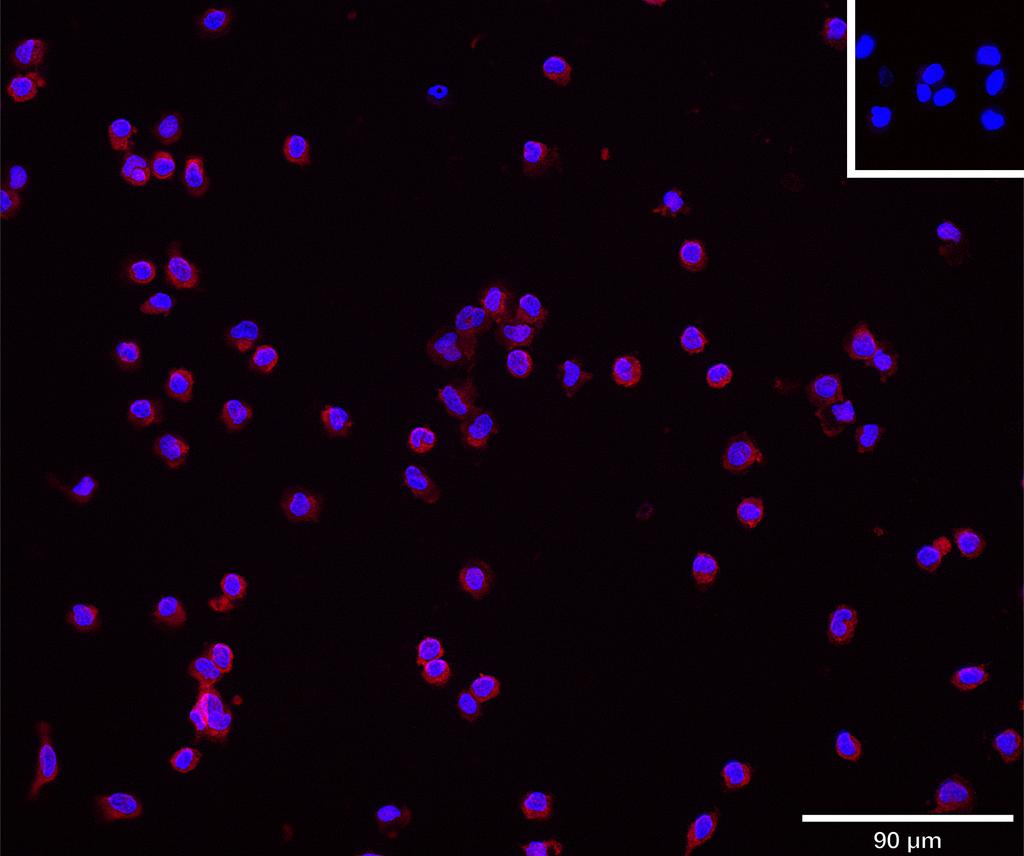 Ankyron CH3L1_HUMAN Clone CV40647