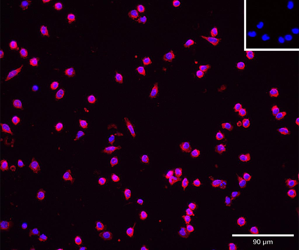 Ankyron CH3L1_HUMAN Clone CV40639