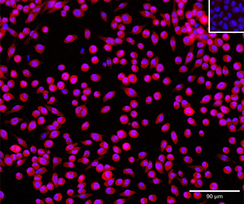 Ankyron CHST3_MOUSE Clone CV40429