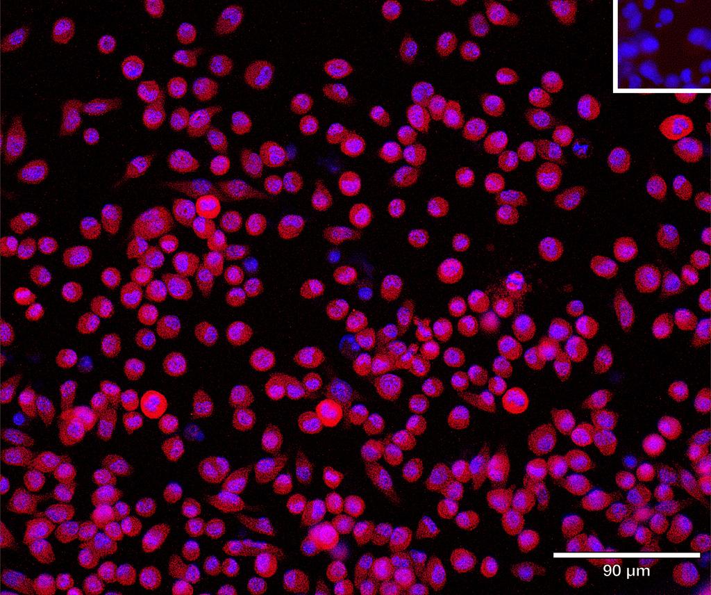 Ankyron CHST3_MOUSE Clone CV40431