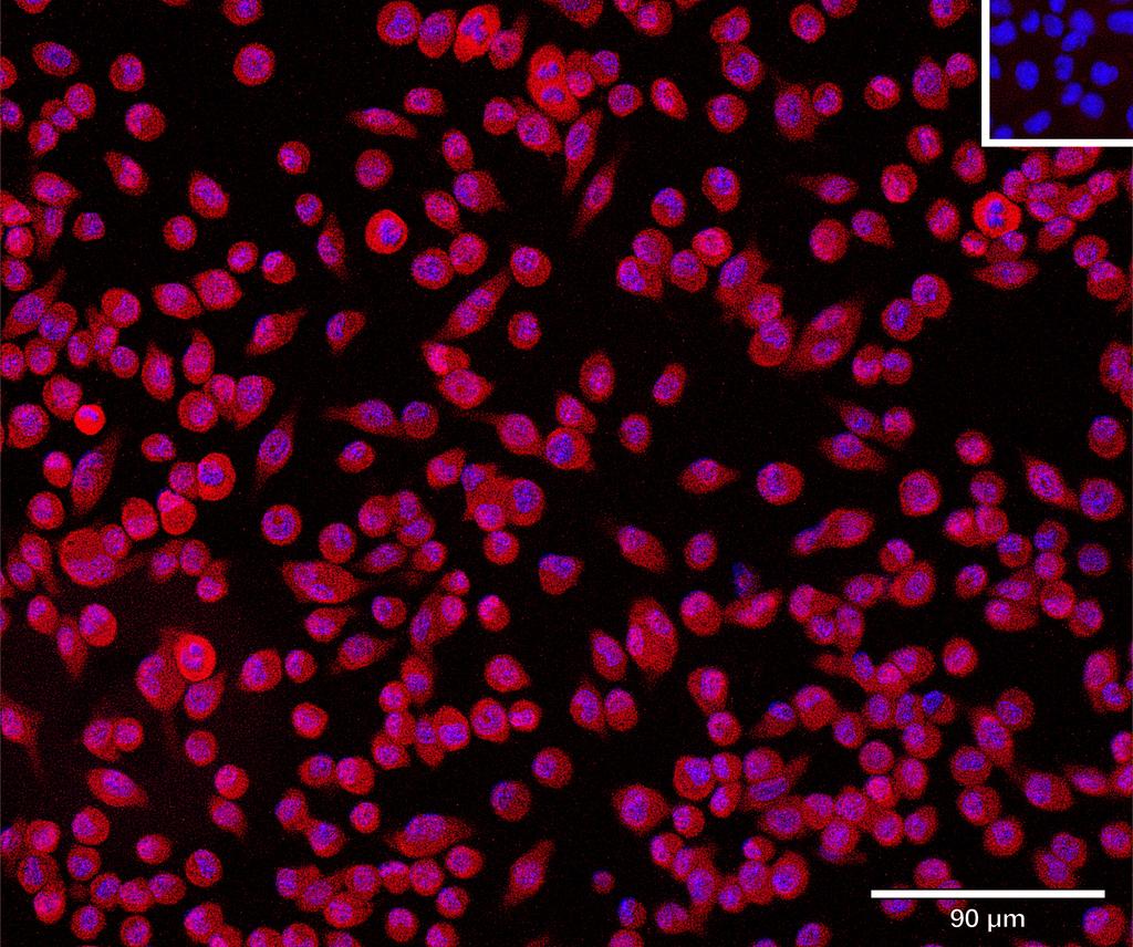 Ankyron CHST3_MOUSE Clone CV40442