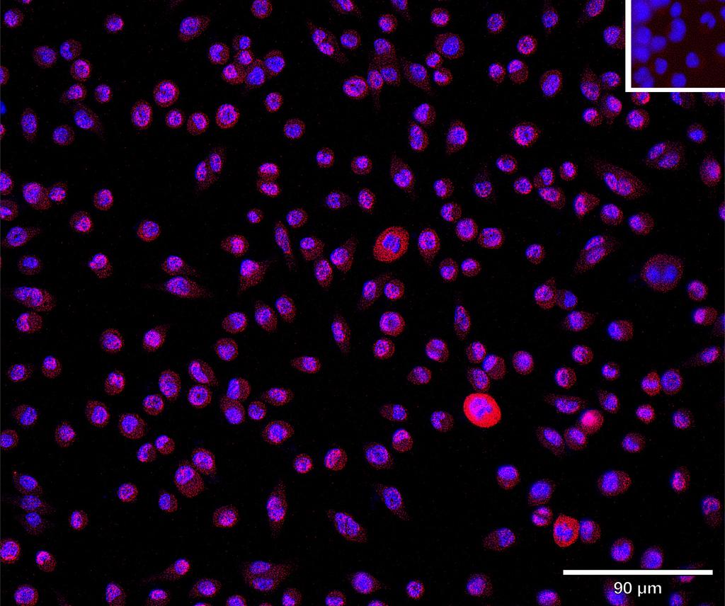 Ankyron CHST3_MOUSE Clone CV40443