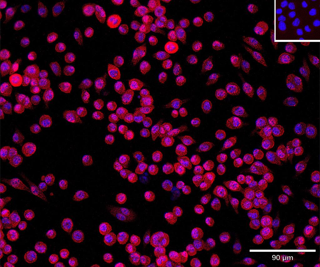 Ankyron CHST3_MOUSE Clone CV40444