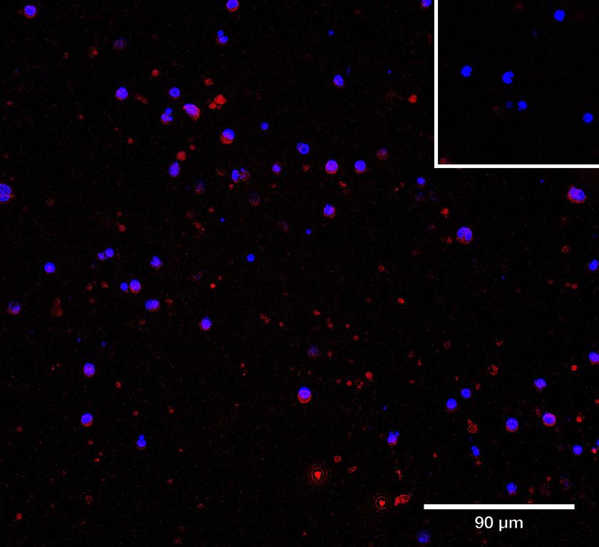 Ankyron CHST6_HUMAN Clone CU30991