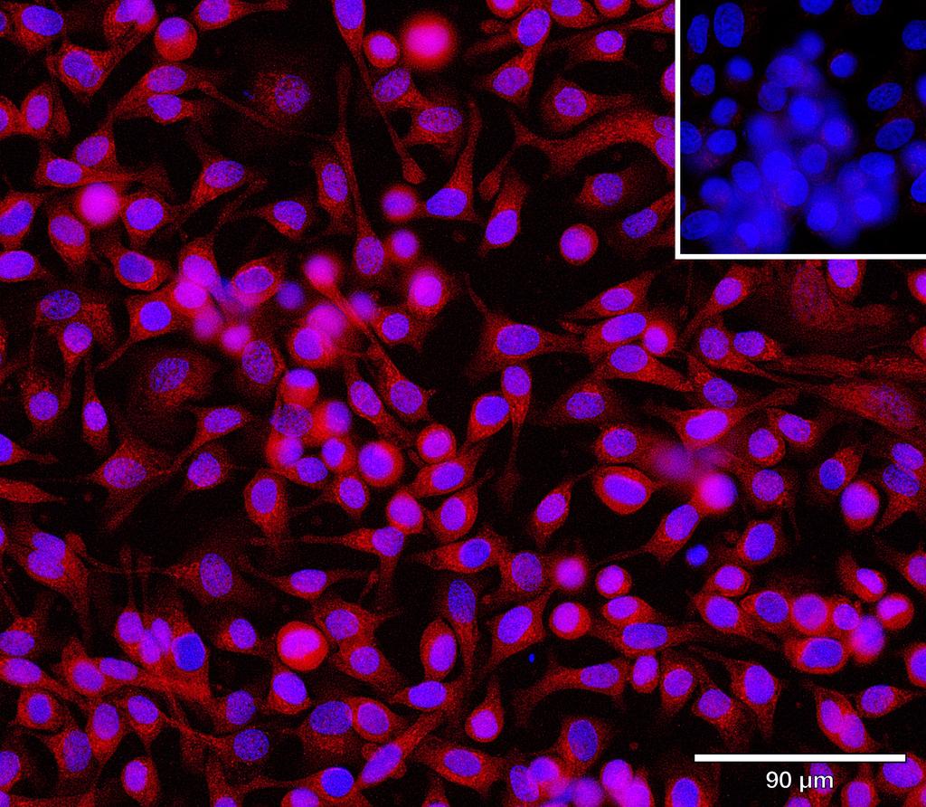 Ankyron CHST9_HUMAN Clone CV40761