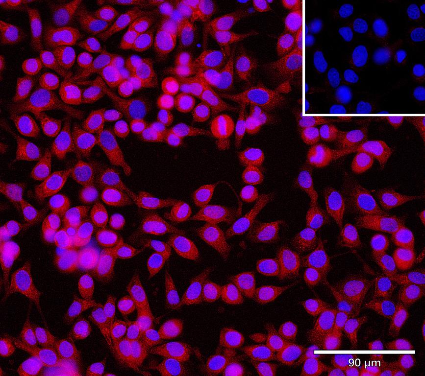 Ankyron CHST9_HUMAN Clone CV40760