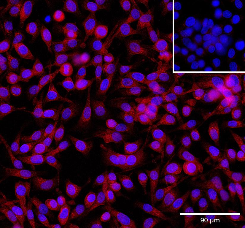 Ankyron CHST9_HUMAN Clone CV40759
