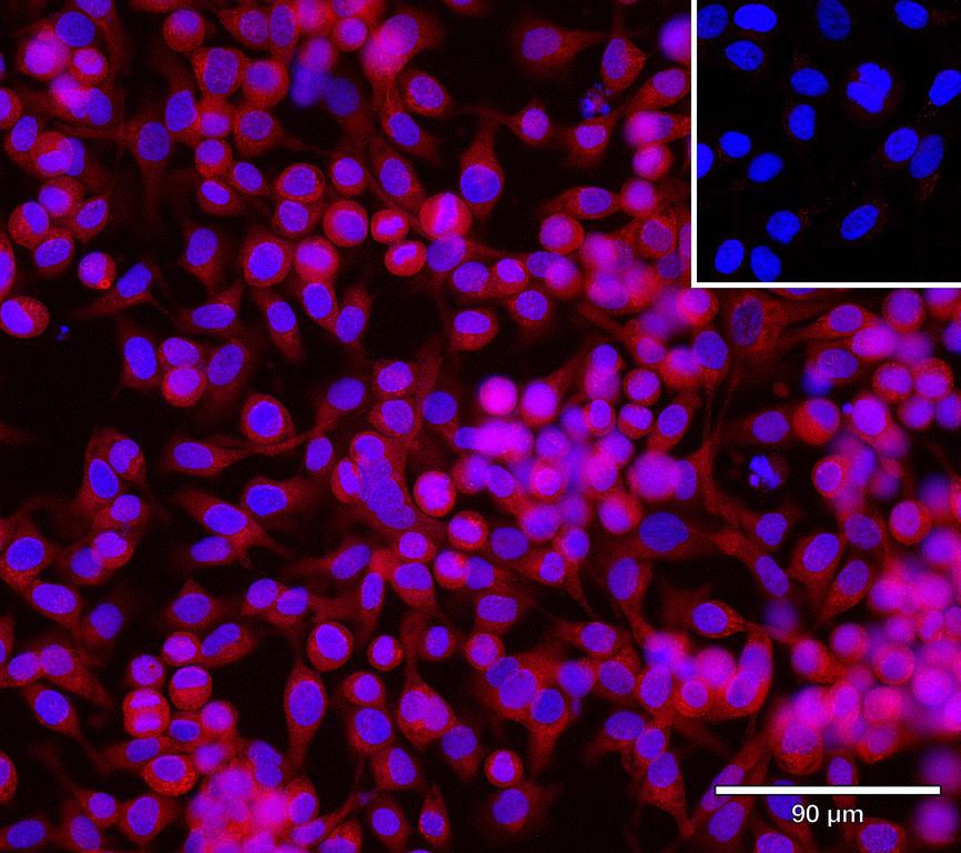 Ankyron CHST9_HUMAN Clone CV40750